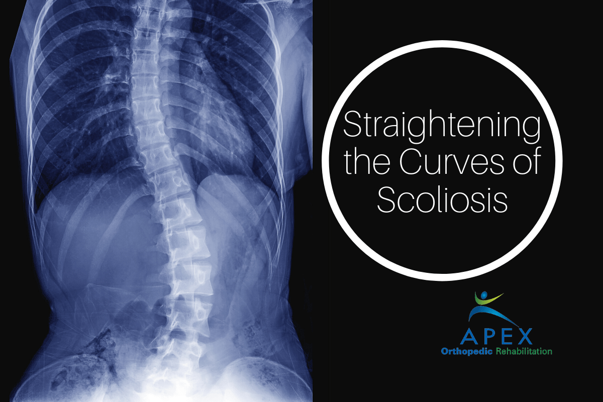 Straightening the Curves of Scoliosis