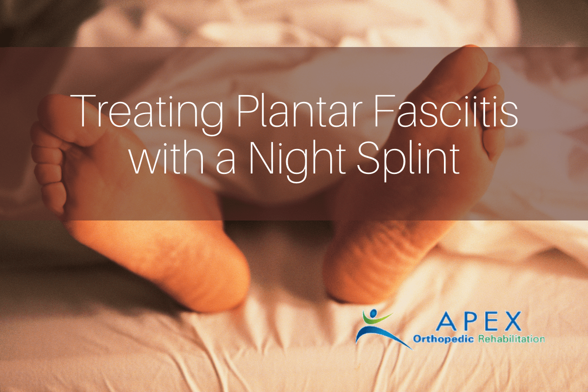 Treating Plantar Fasciitis with a Night Splint