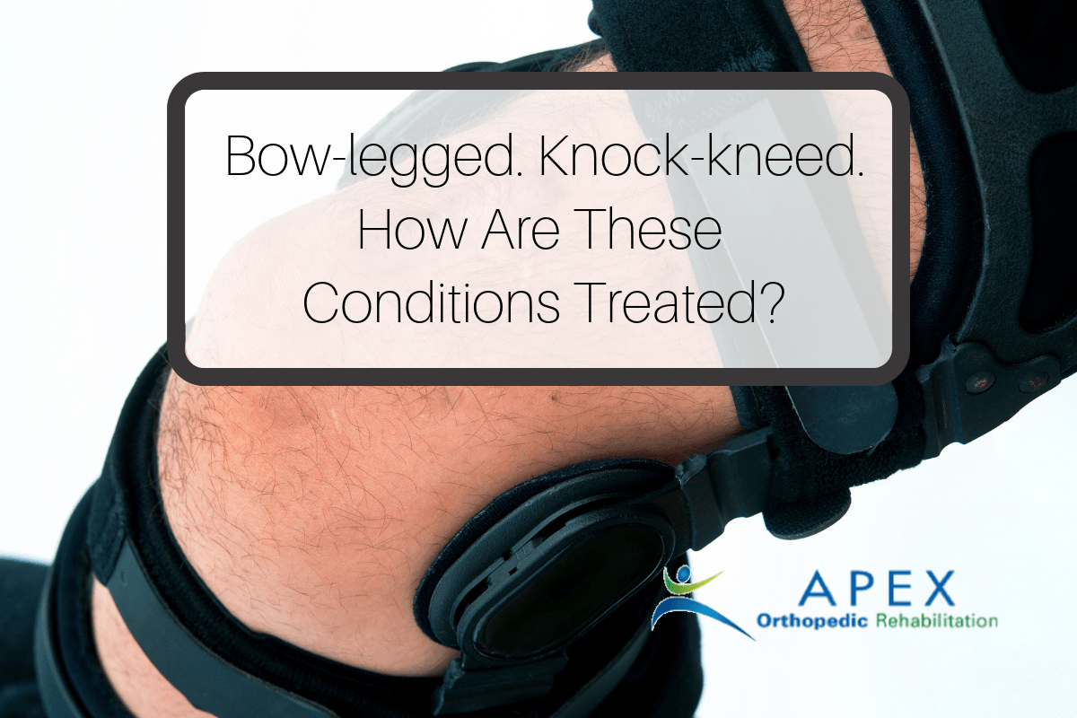 Bow-legged. Knock-kneed. How Are These Conditions Treated?