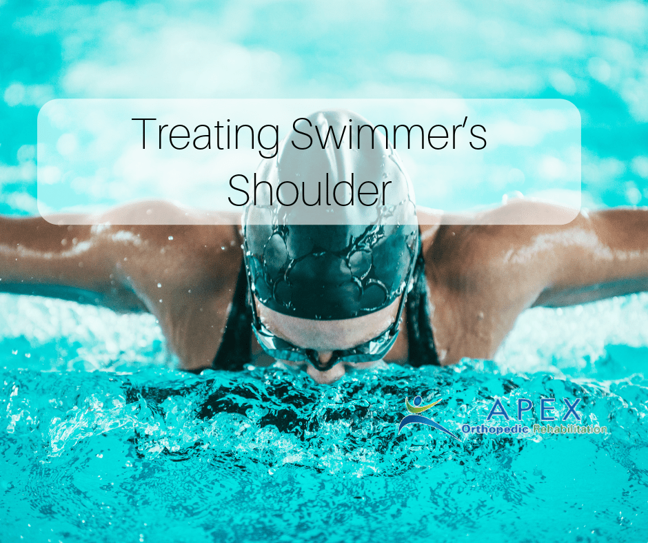 Treating Swimmer’s Shoulder